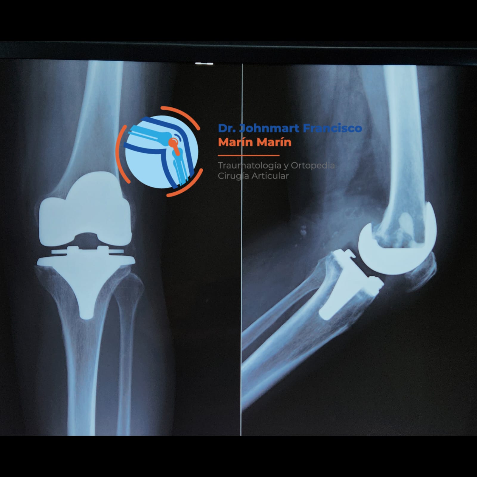 caso-1-image-3