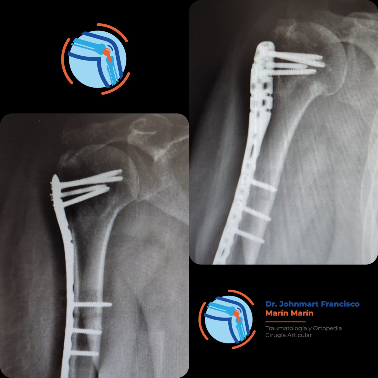 caso-3-image-2