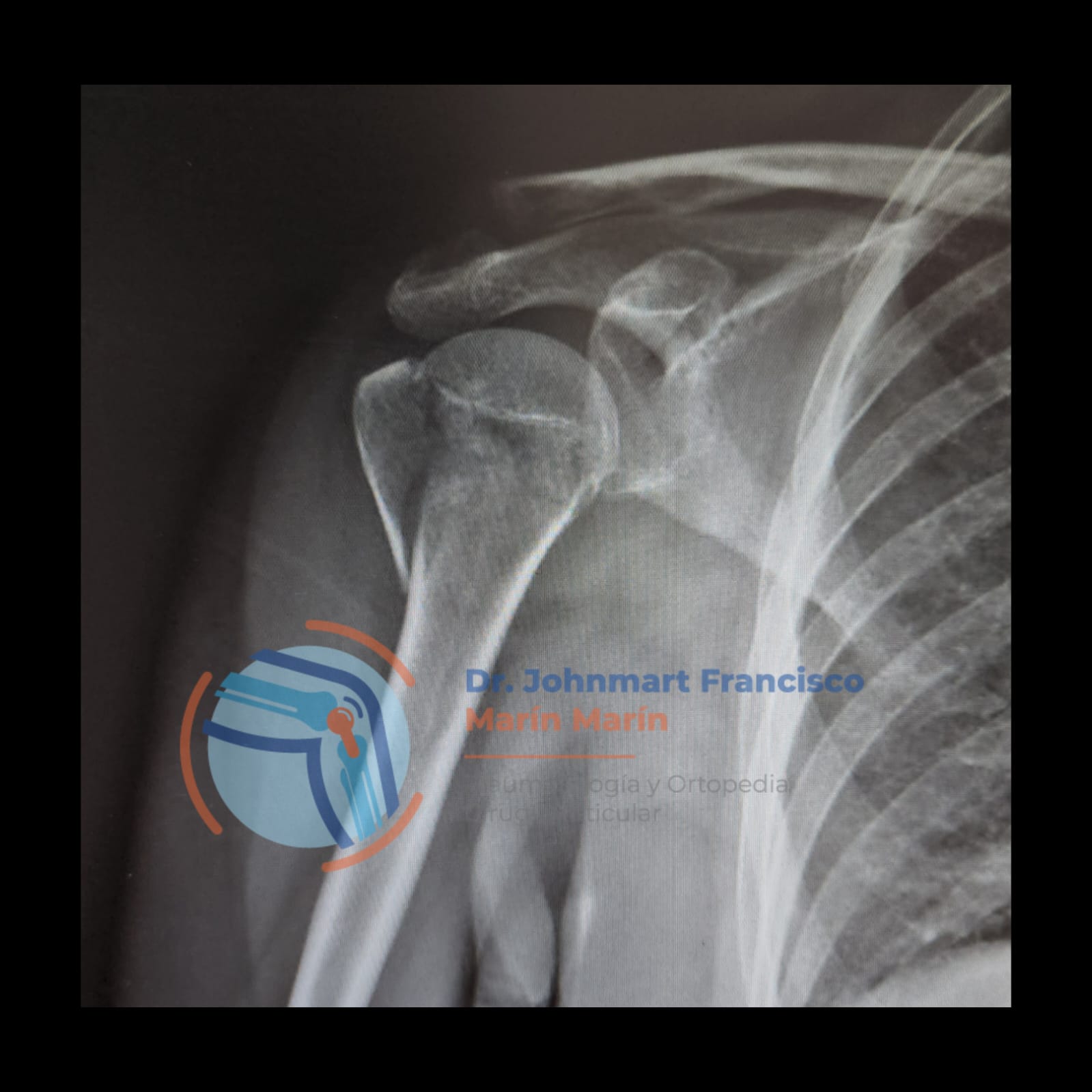 caso-3-image-3